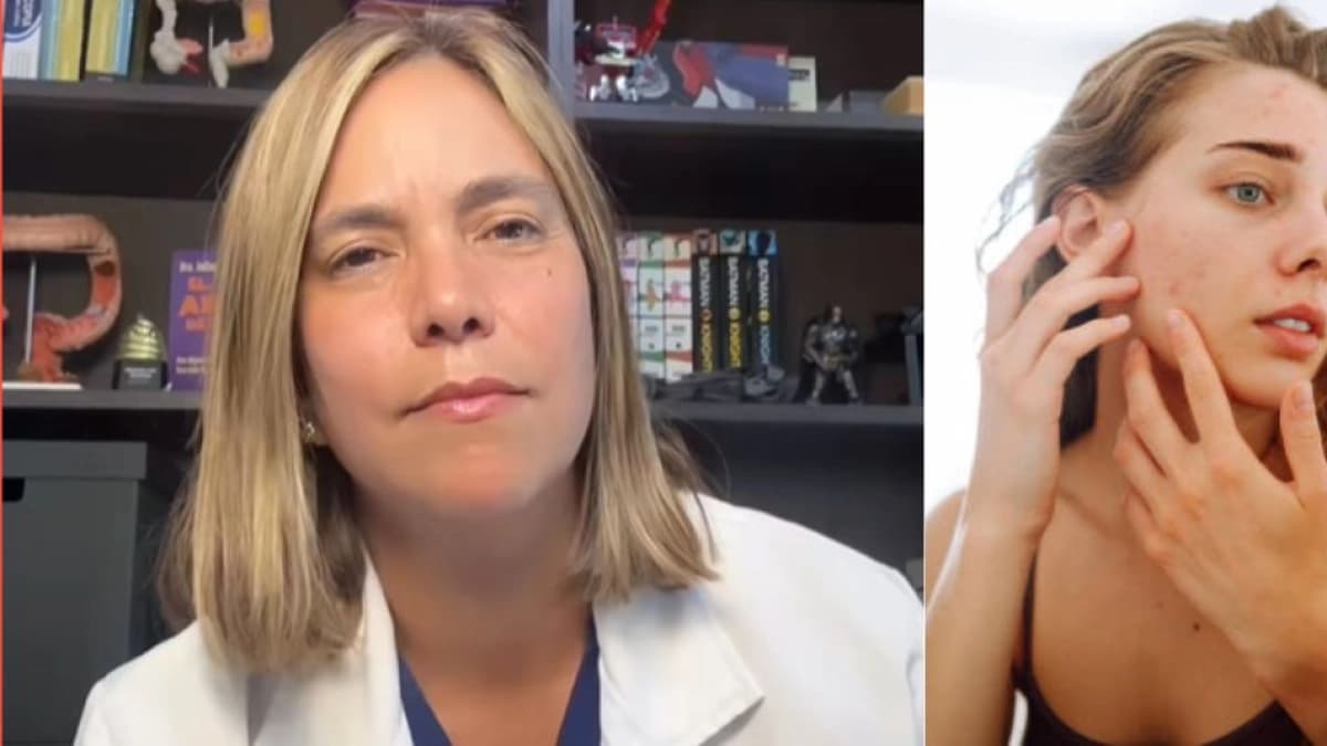 El Tiempo — Salud — La gastroenteróloga Juliana Suárez advierte, sin tapujos, sobre las enfermedades en la piel que tienen relación con el intestino